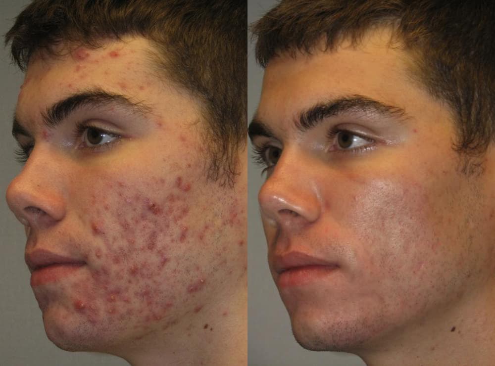 Before and after transformation